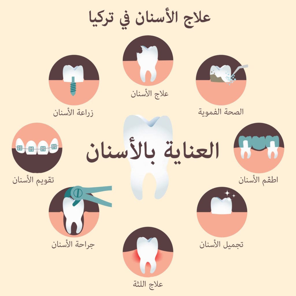 علاج الأسنان في تركيا