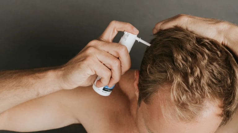 Read more about the article مينوكسيديل لعلاج تساقط الشعر